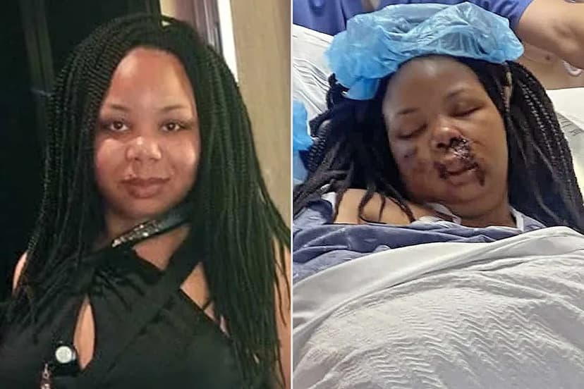 Honduras Trip Turns Horrific: Woman Ejected From ATV Into Tree