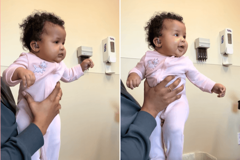 Baby Hears Mom's Voice for First Time