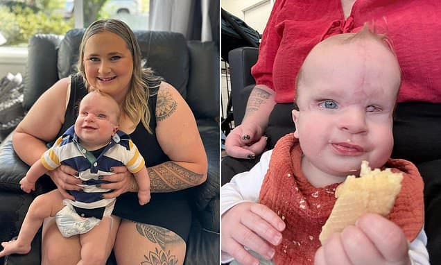 Son Born With Rare Condition Defies Odds