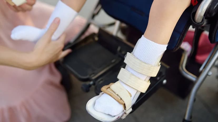 Baby Teeth Stem Cells: New Hope for Cerebral Palsy?