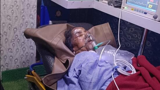 Bhayander Fire Claims First Life: Woman Succumbs to Burn Injuries