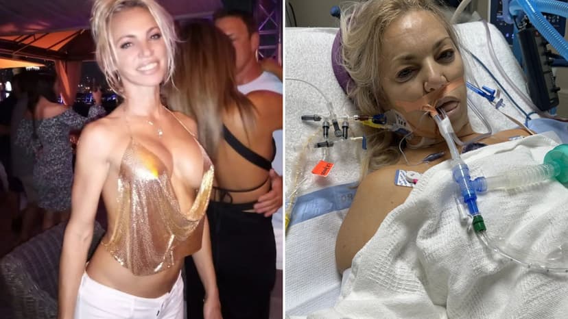Boob job nightmare: Woman's life ruined by ruptured implant