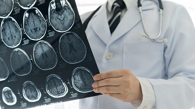 Vitamin B12 Variant Fights Deadly Brain Cancer