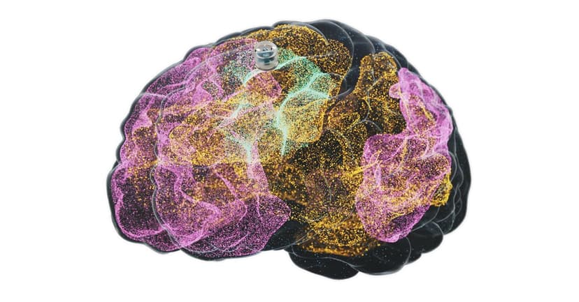 New Implant Offers Hope for Treatment-Resistant Depression