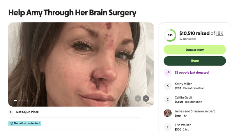 Seizure Leads to Brain Tumor Discovery; Fundraiser Launched