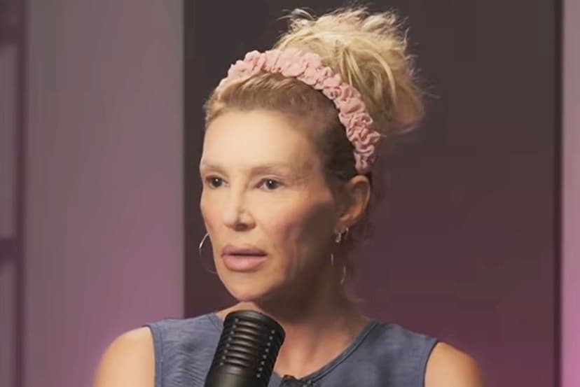 Brandi Glanville Faces 'Something Eating My Face' Surgery