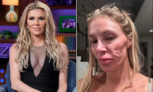 Brandi Glanville's Mystery Diagnosis Revealed!