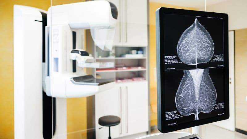 Breast Cancer: Global Divide Widens