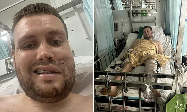 Leg 'Hanging Off': British Tourist's Thai Nightmare