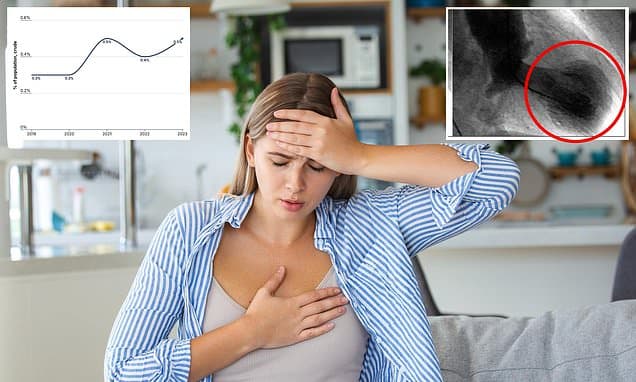 Broken Heart Syndrome: A Real, Alarming Condition