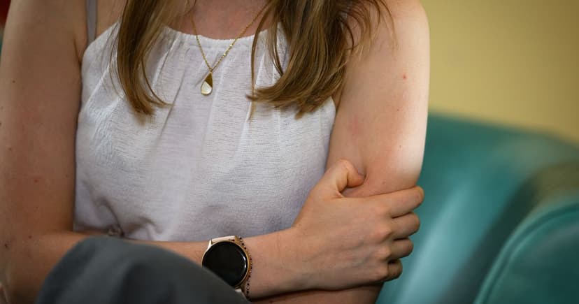 Spider Bite Leads to Extreme Full-Body Meltdown