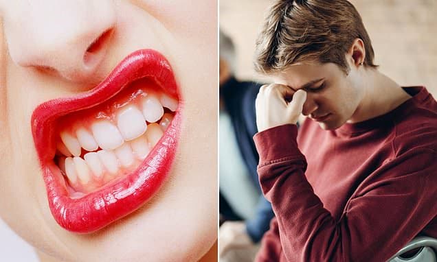 Hidden Jaw Pain: Millions Suffer Unseen Headaches