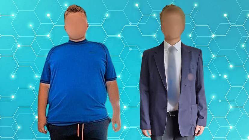 Bullied Teen Transforms Life with Groundbreaking Weight Loss Treatment