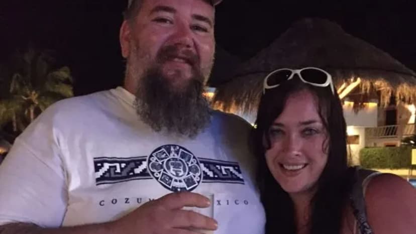 Epileptic Fit Ignites Burn Nightmare: Grafted Skin Horror