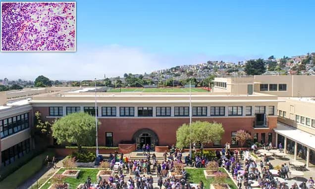 Third TB Case Confirmed at Elite California High School