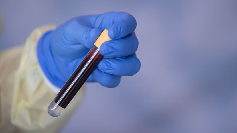 Cancer Blood Test Fails Key Trial