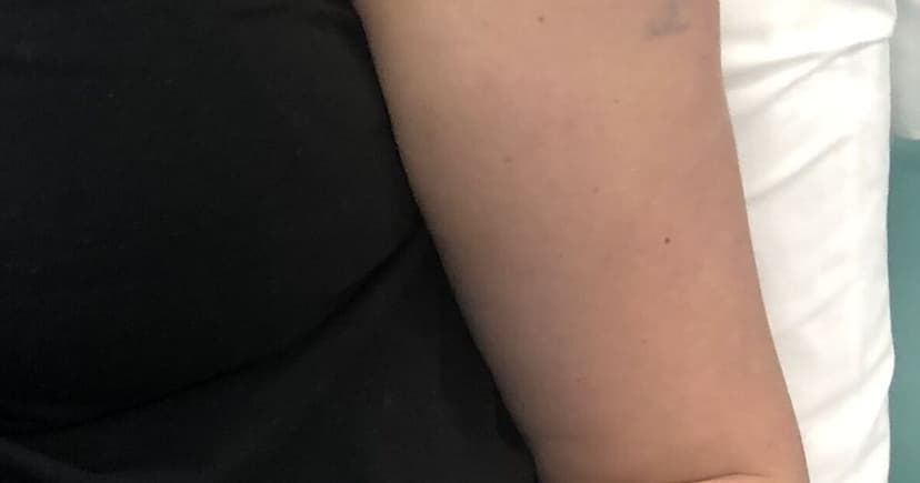 Cancer Support Service Funding Shift Sparks Patient Fears