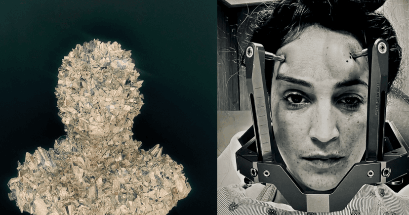 Stage IV Cancer Patient Transforms Radiation Mask into Art