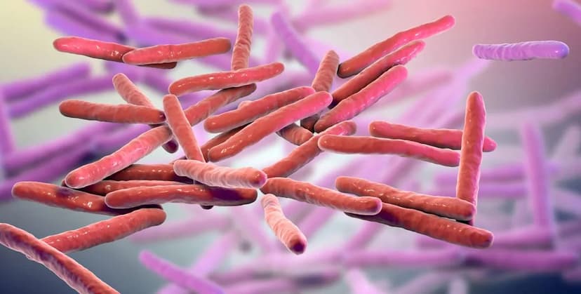Central Florida: A Hotspot for Rare Leprosy Cases