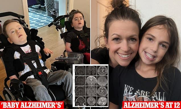 Tiny Genetic Flaw Causes 'Baby Alzheimer's'