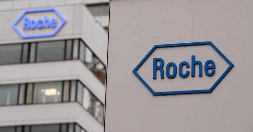 Alzheimer's Blood Tests Arrive in China