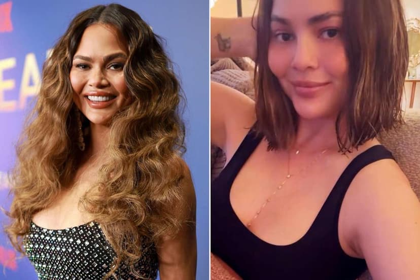 Chrissy Teigen Debuts Dramatic Bob After Hair Loss Procedure