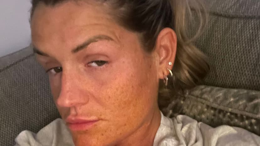 Mum's Codeine Addiction: 70 Pills Daily After Surgery