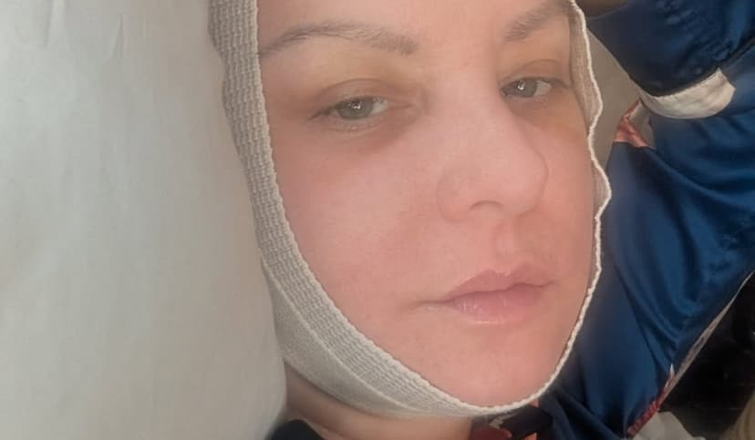 Comedian's Neck Surgery Keeps Her from Oscars Event