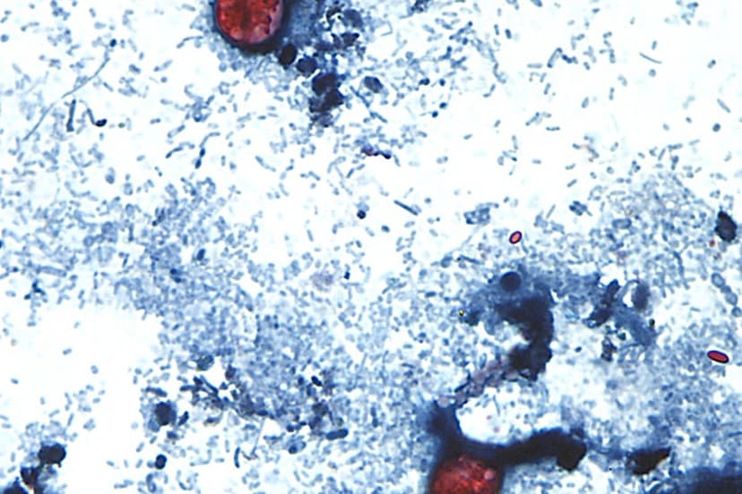 Cyclospora Outbreak: 2026 Becomes Worst Year Yet