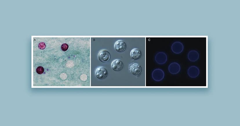 Parasite Outbreak: Thousands Sickened by Cyclospora