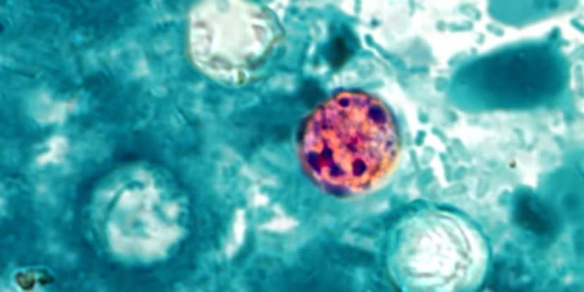 Diarrhea Outbreak: Cyclospora Sickens Thousands Nationwide