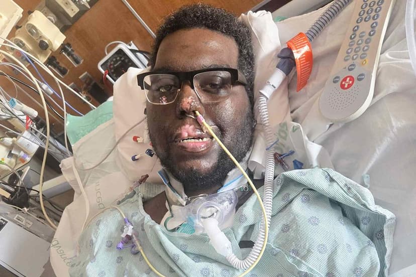 Dad Loses Limbs After Routine Dentist Appointment