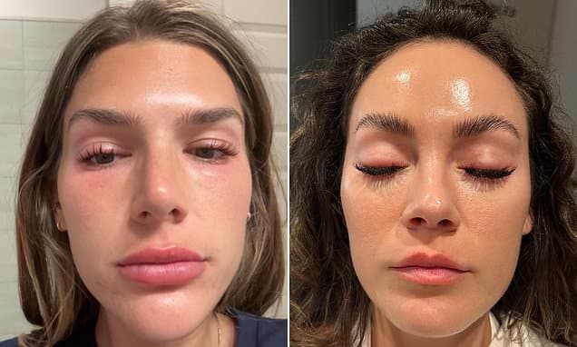 Lash Lifts & Extensions: Beauty's Dangerous Risks
