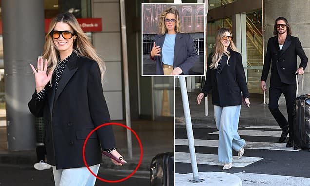 Delta Goodrem's Kettle Mishap: Burned Hand, Swift Recovery!