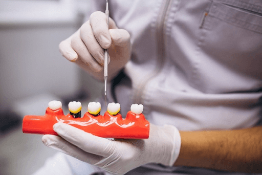Dentist Fined Rs 2 Lakh Over Flawed Root Canal Treatment