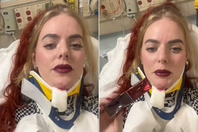 Bike Crash Victim's Flawless Lipstick Steals the Show