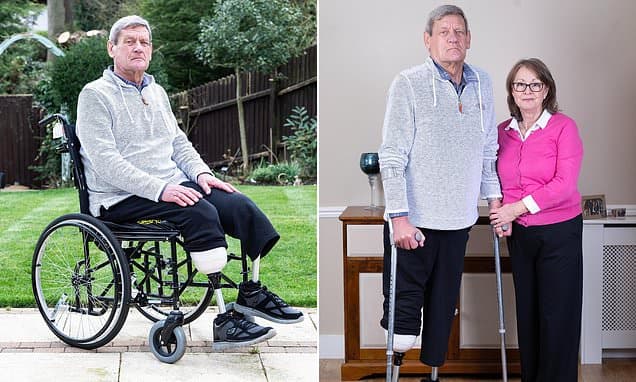 Legs Amputated After Delayed Diagnosis: A Harrowing Tale