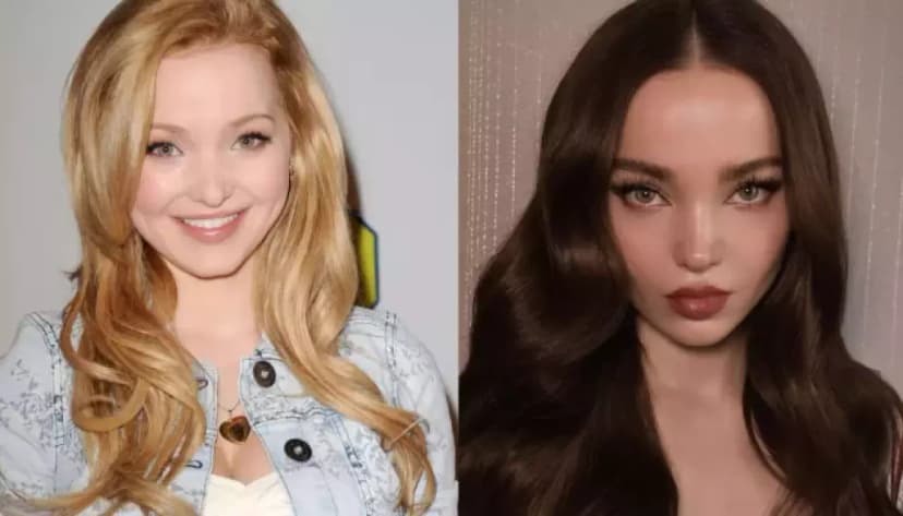 Dove Cameron's Secret Surgeries Revealed?