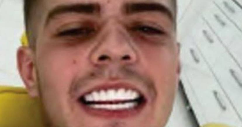 Selfie Snafu: Drug Dealer's 'Turkey Teeth' Pic Leads to Arrest
