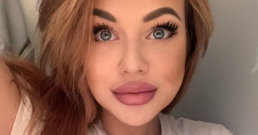 Legs Rotting After Drunk Pass-Out: A Mother's Warning