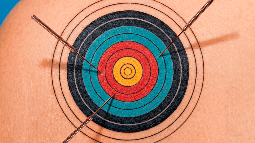 Dry Needling: Pain Relief Breakthrough or Hype?