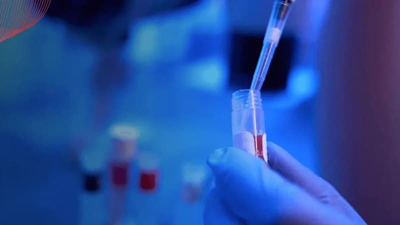 New Blood Test Detects Deadly Throat Cancer Early