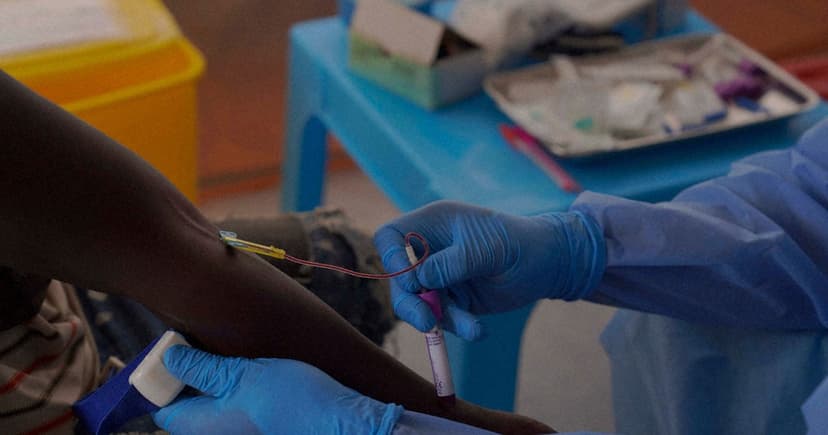 New Drug Trial Aims to Stop Ebola Before Symptoms