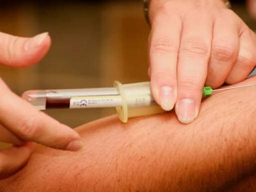 Fake Doctor Drains Elderly's Savings with 'Black Blood' Scam