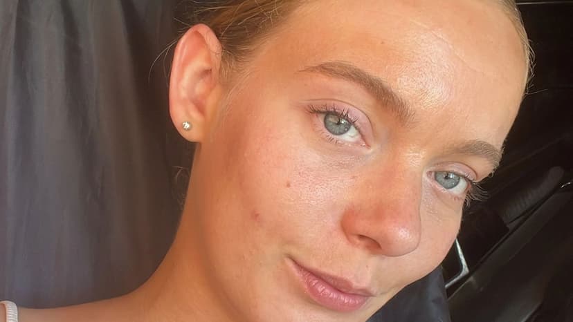 Brain Swelling Leaves Woman With Amnesia