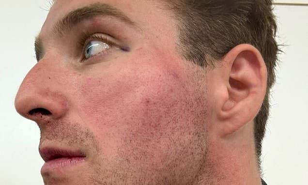 Ex-Cop Blasts Met Over Deported Pickpocket Suspect