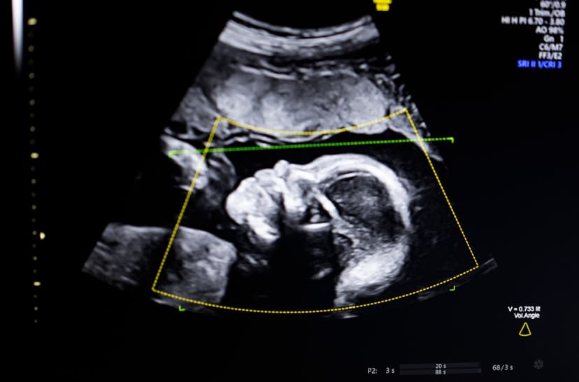 AI Detects Fetal Abnormalities: FDA Clears Biotics AI