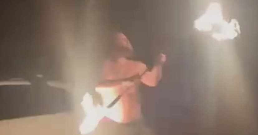 Fire-Breather's Face 'Melts' in Horrific Stunt Gone Wrong
