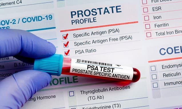 Prostate Screening Model Flawed, Charities Claim