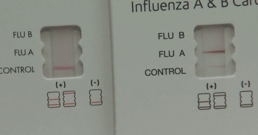 Flu Cases Surge: Prevention Takes a Backseat